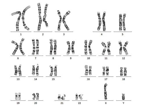 What is chromosome?