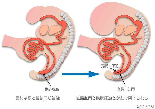 正常妊娠初期に総排泄腔から直腸肛門と膀胱尿道ができる過程