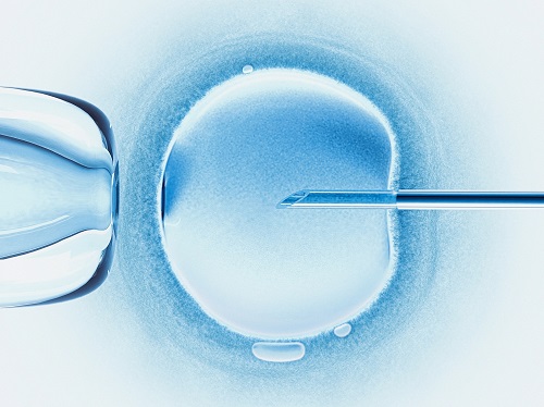 顕微受精（卵子に精子を人工的に入れて受精させる方法）