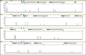 QF-PCR法データ