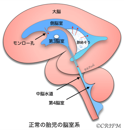 正常の胎児の脳室系